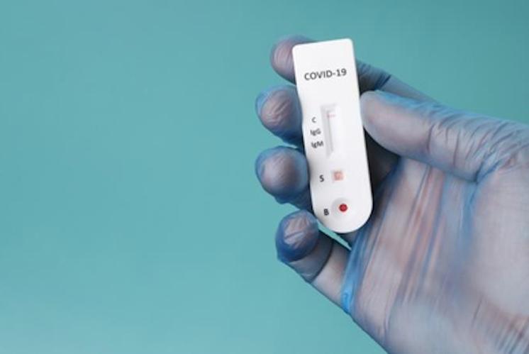 Zürcher Kirche testet ihre Mitarbeitenden kostenlos