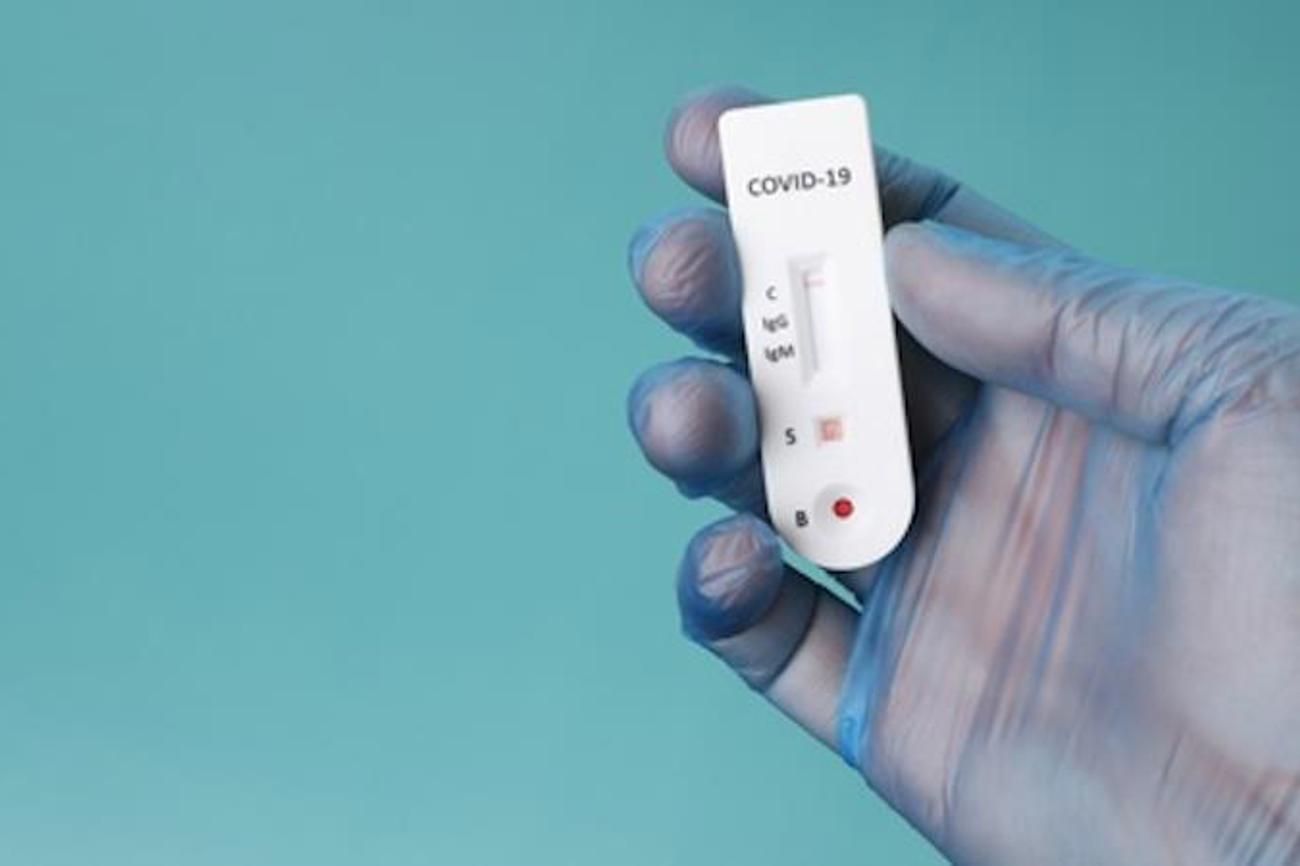 Ist der Schnelltest positiv, wird vor Ort noch ein PCR-Test durchgeführt. |Tim Reckmann/Pixelio
